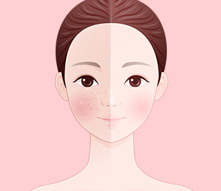 西婵